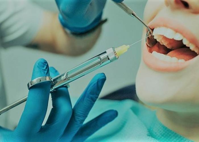 بنج الأسنان 