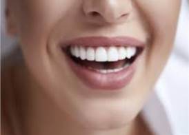 بياض الاسنان 