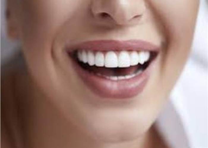 بياض الاسنان 